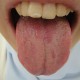 学生舌