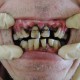 歯・口腔と全身状態の深い関係
